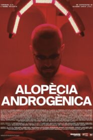 Androgenic Alopecia