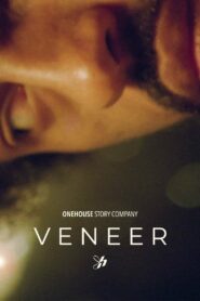 Veneer