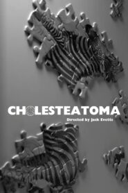 Cholesteatoma